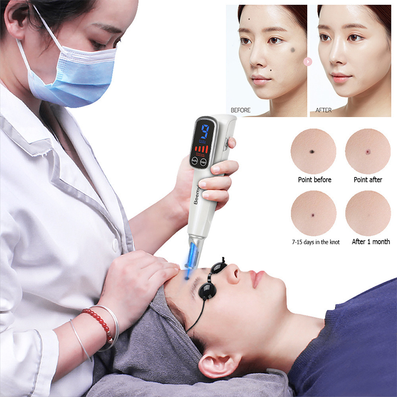 # قلم ليزر احترافي بتقنية البي - مراجعة Blue Light Therapy Pen Acne Spot وسعره