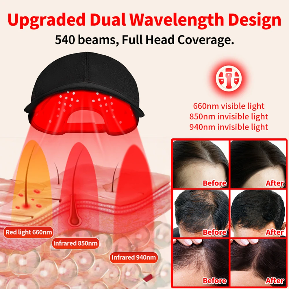 180 قطعة المصابيح الأشعة تحت ا - مراجعة Red Light Therapy Torch 660Nm وسعره